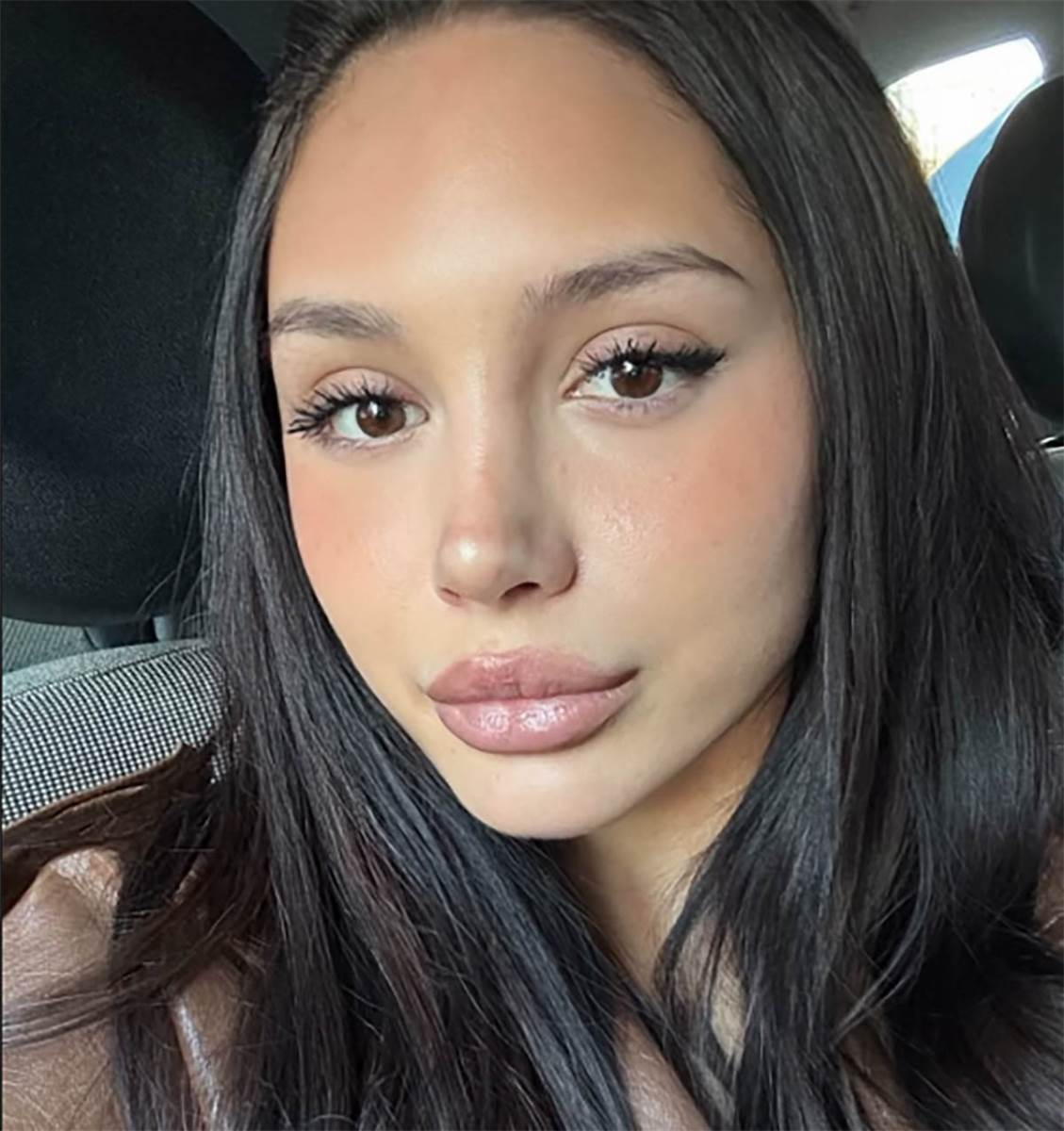 Nina Đogani operisala nos jer je bio veliki na fotkama: "U ogledalu nikada mi nije predstavljao problem"