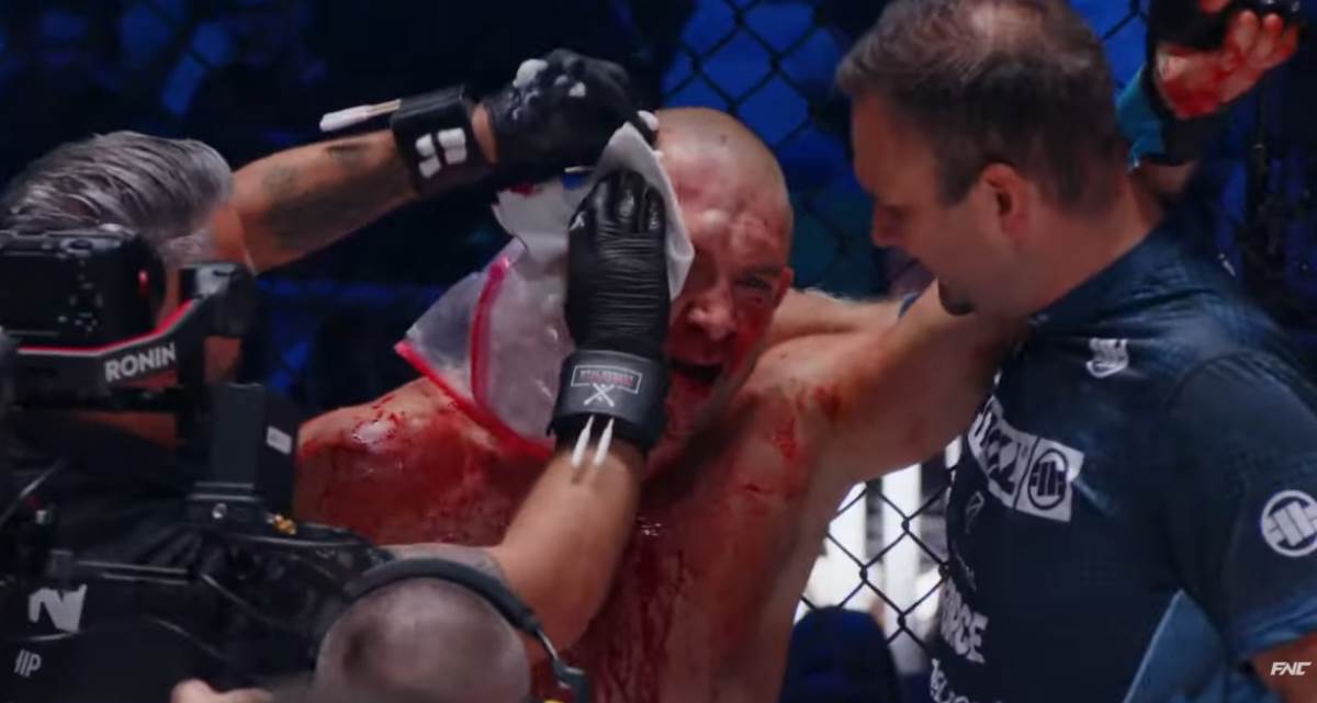 Sašo Klinc umazan krvlju u borbi protiv Vuka Lekića