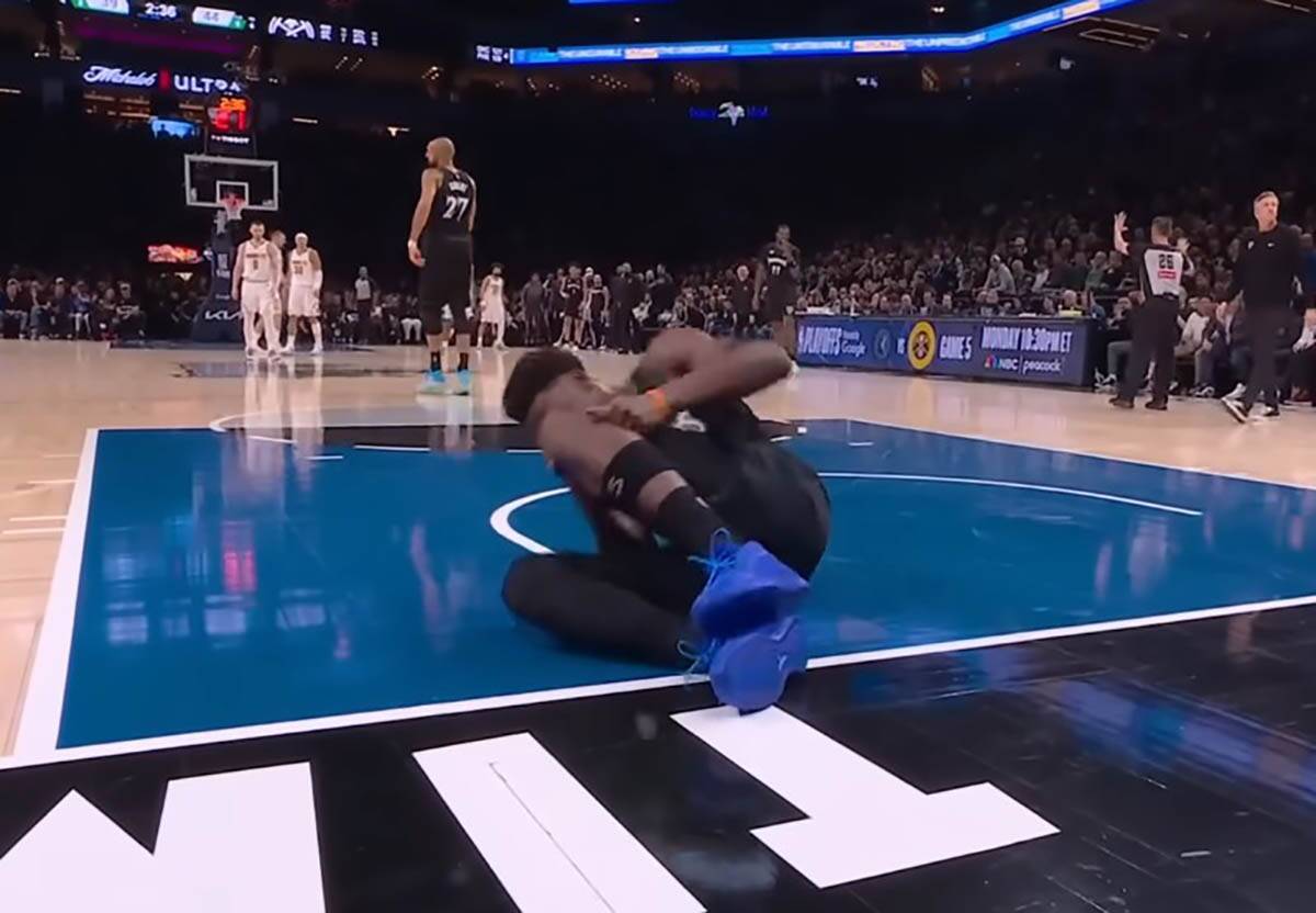 Entoni Edvards povreda (5).jpg