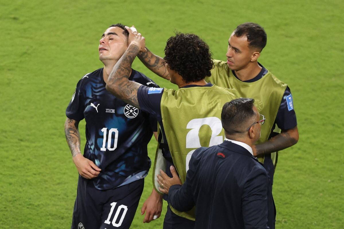 Migel Almiron dobio crveni karotn zbog pokrivanja lica