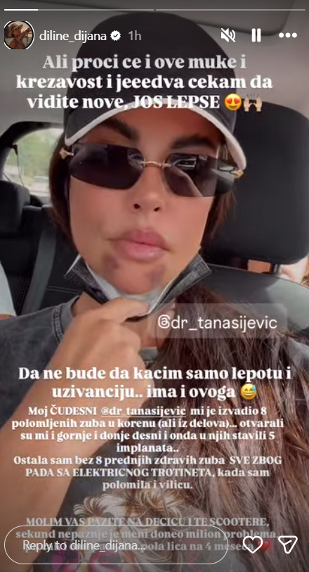 Dijana Dilajn