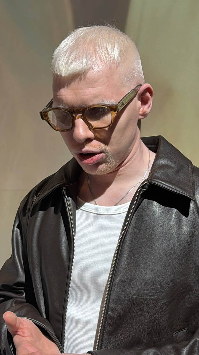 Albino (5).jpg