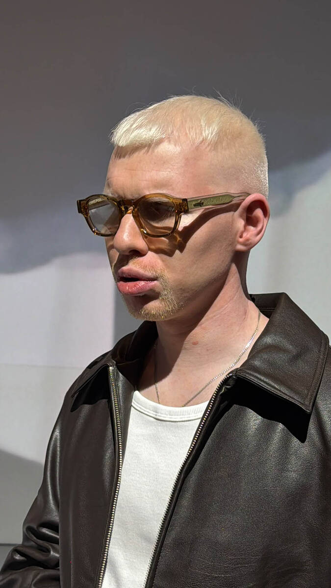 Albino (6).jpg