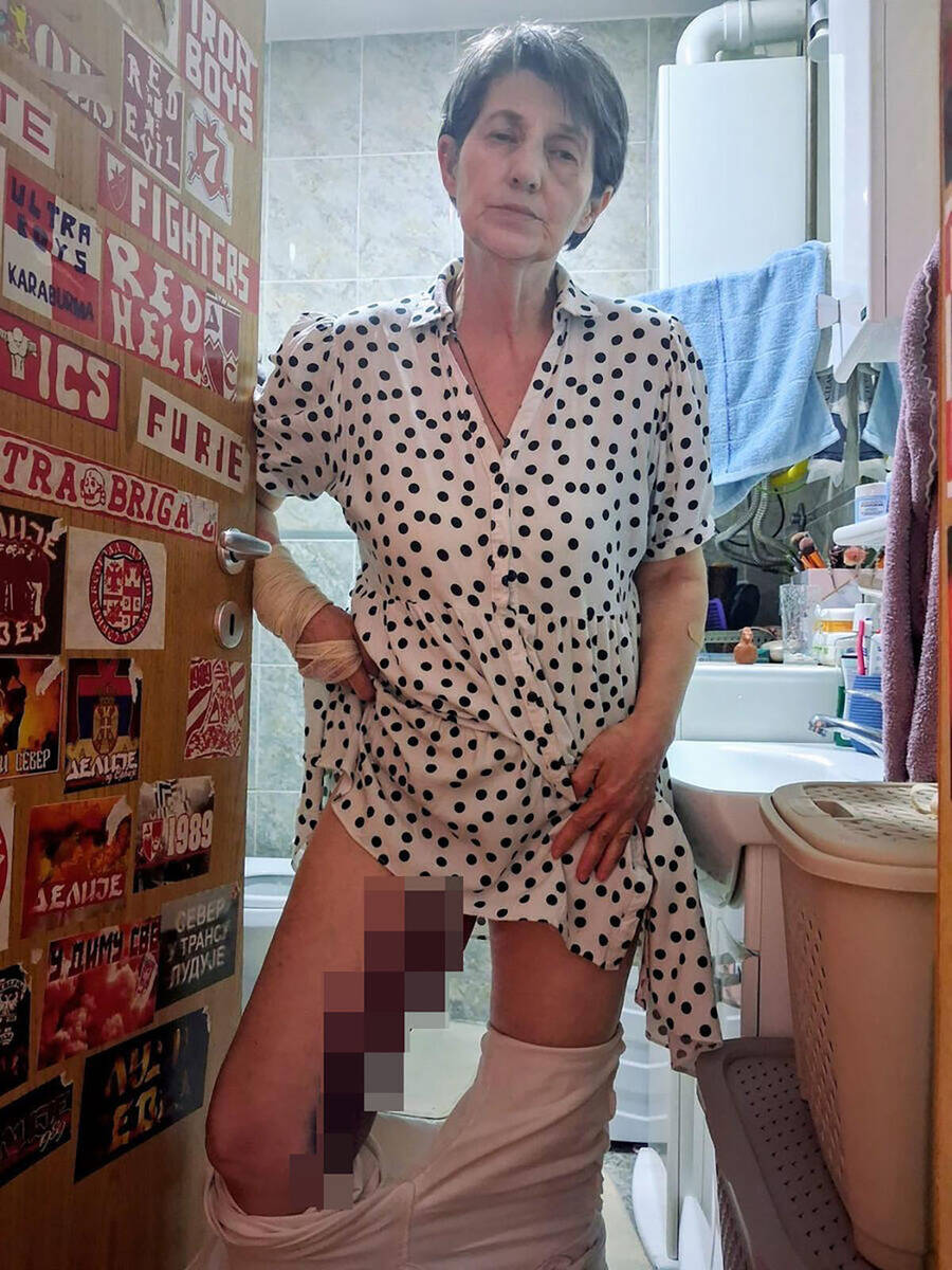 Nada Pucarević, slike nakon prebijanja Kristijan Golubović (1).jpg