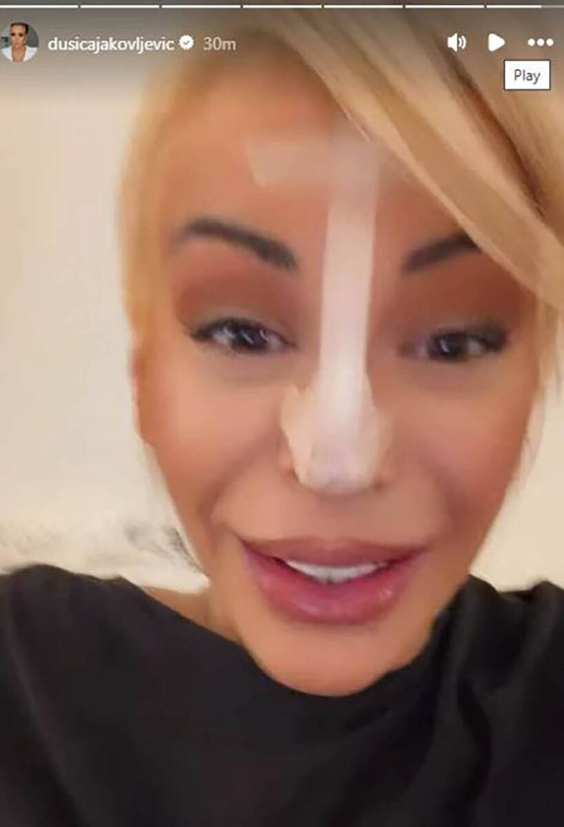 "Pao mi je vrh nosa": Dušica Jakovljević šokirala prizorom, celo lice oblepila flasterima