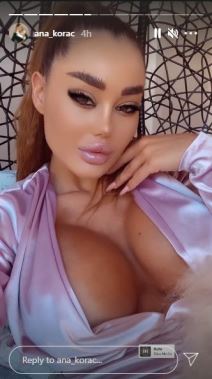 ana korac operacije nove obrve silikoni