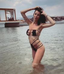 Ana Rajković promena na licu posle 5 godina