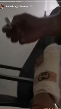 ljuba perucica zena u gipsu