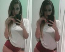 Tea Tairović pre plastičnih operacija