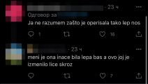 iva grguric operisala nos komentari