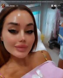 ana korac botoks