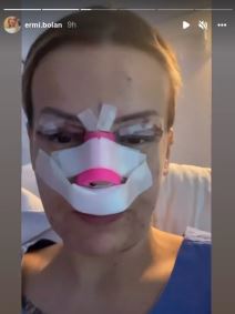 Ermina Pašović operisala nos i kapke