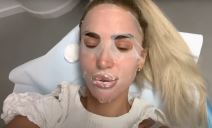 aleksandra nikolic vadila silikon iz usana (5).png