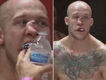 ufc povreda nosa.jpg