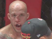 UFC povreda nosa  (3).jpg