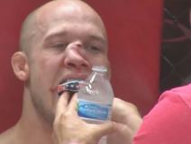 UFC povreda nosa  (4).jpg