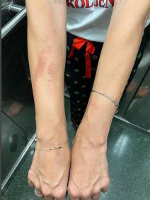 Ko su Severinine rođene sestre sa kojima ne razgovara