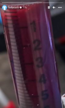 Bela Hadid u bolnici (2).PNG