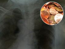 Rtg-snimak-novcici.jpg