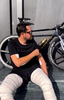 Albertu Kontadoru uklonjeno 100 tumora