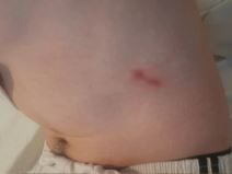 Pretučen srpski mladić na Kosovu 3.png