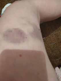 Žrtva nasilja  (3).jpg