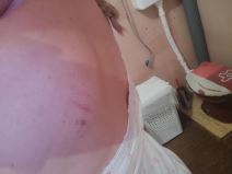 Žrtva nasilja  (4).jpg