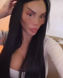 posle plastičnih operacija (5).jpg