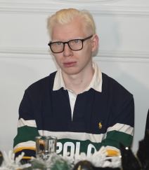 albino3.JPG