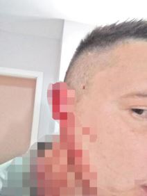 Gazda radniku odgrizao uvo  (3).jpg