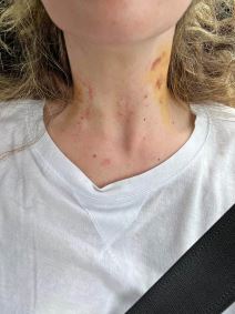 Nada Grujičić žrtva porodičnog nasilja ispovest Mondo