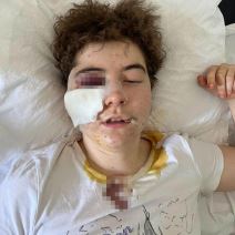 devojka   pretucena.jpg