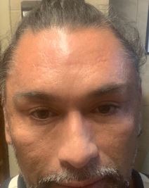 Kako danas izgleda Marselo Rios