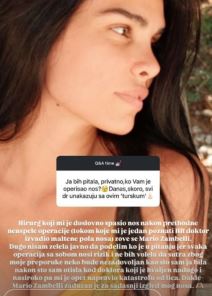 Jovana Đorđević o plastičnim operacijama unakazili je