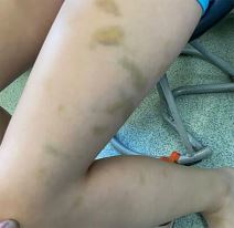 Vršnjak pretukao dečaka (1).jpg