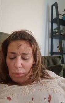 Ana Nikolić pretučena (4).jpg