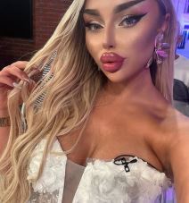 Sve plastične operacije Sofije Janićijević