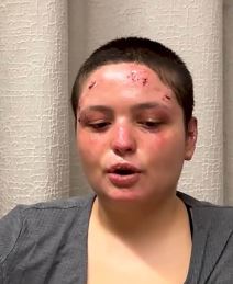 Preživela žrtva požara u Švajcarskoj (5).jpg