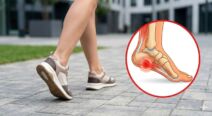 bol u stopalu plantarni fascitis.jpg