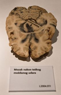 Šta se krije u ljudskom telu