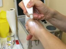 Oftalmološki pregledi i nehirurške metode usporavanja starenja Belloko 