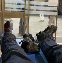 Surreal slomio nogu na nastupu