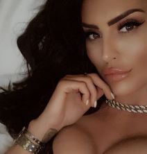 laura braun plasticne operacije pre i posle instagram foto