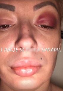 Nevena Hot se udala za kralja zlata