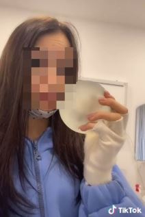 maloletna influenserka ugradila silikone sestra sare damnjanovic