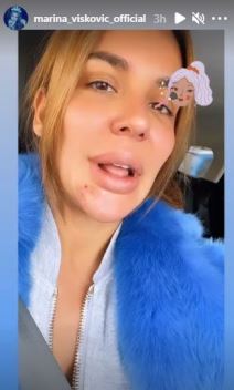 marina viskovic bez sminke kraste na bradi