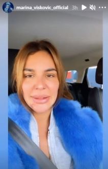 marina viskovic bez sminke kraste na bradi