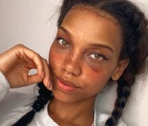 plasticni hirurg operacija celo smanjivanje zatezanje