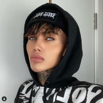 muskarci plasticne operacij instagram filter levi jed murphy