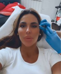 marina viskovic plasticne operacije botoks video